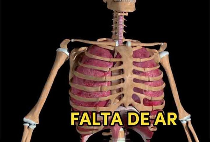 Arritmia