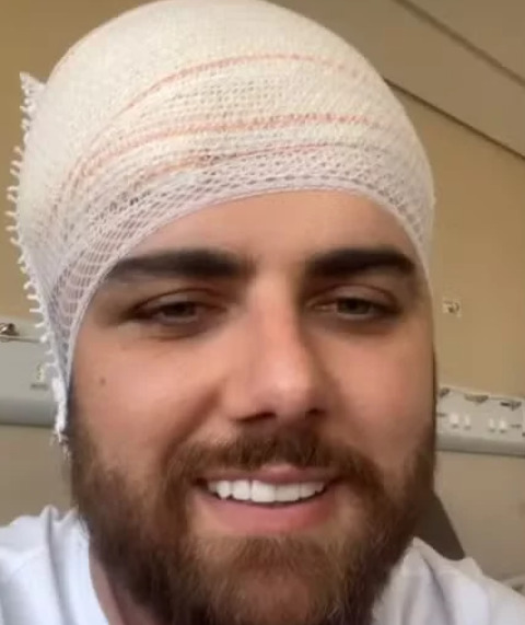 No dia 2/10, Zé Neto recebeu alta após quatro dias de internação no Hospital de Base de São José do Rio Preto, no interior de São Paulo. Ele tinha batido com a cabeça em uma barra de um veículo UTV no dia 28/09 e sofreu um corte grande na cabeça.  Mas o cantor Cristiano, que faz dupla com ele, já havia tranquilizado os fãs:  