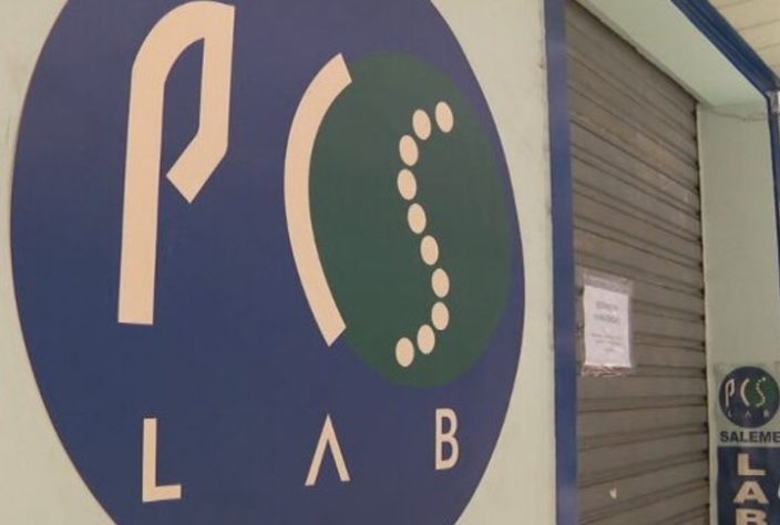 Transplante de órgãos de pessoas com HIV aids RJ