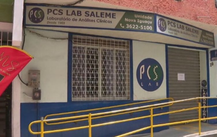 Transplante de órgãos de pessoas com HIV aids RJ