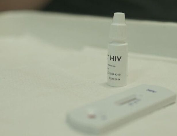 Transplante de órgãos de pessoas com HIV aids RJ