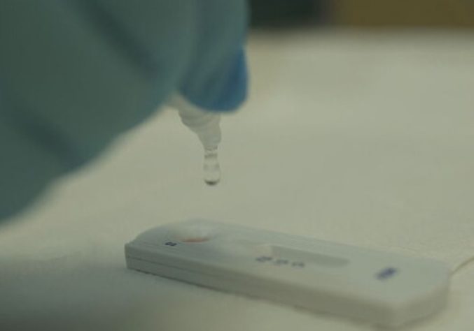 Transplante de órgãos de pessoas com HIV aids RJ