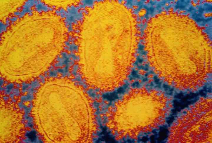 Essa é uma condição na qual as bactérias e outros microrganismos deixam de responder a antibióticos.
