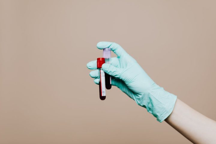 Foram analisadas amostras de sangue de 52 participantes. Em oito casos, o exame acusou mutações cancerígenas meses antes do diagnóstico clínico.