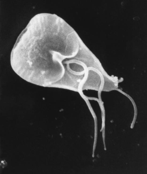 GiardÃ­ase - Causada pelo protozoÃ¡rio Giardia lamblia, a infecÃ§Ã£o ocorre pelo consumo de Ã¡gua ou alimentos contaminados. Os sintomas principais sÃ£o diarreia, dor abdominal e nÃ¡useas.