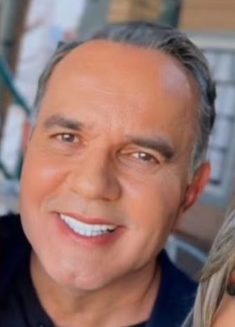 harmonização facial