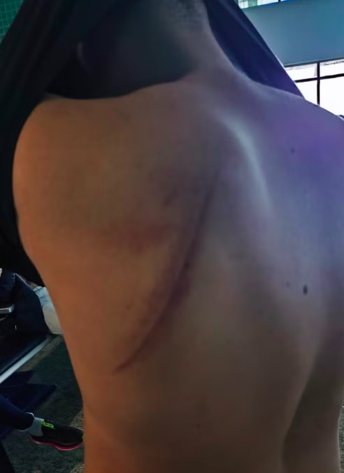 Os deportados, que estavam em situação ilegal no país norte-americano, relataram ter sofrido agressões e humilhações durante o voo, chegando algemados nas mãos e nos pés.