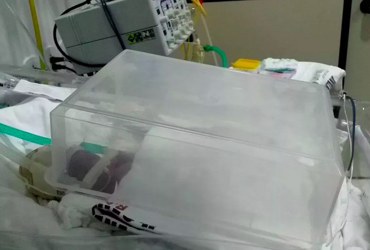 Caixa de plástico: Em 2019, no Amapá, uma bebê prematura precisou ser mantida viva com uma incubadora feita de uma caixa de plástico. Na ocasião, quatro crianças necessitavam do equipamento, mas apenas um funcionava.