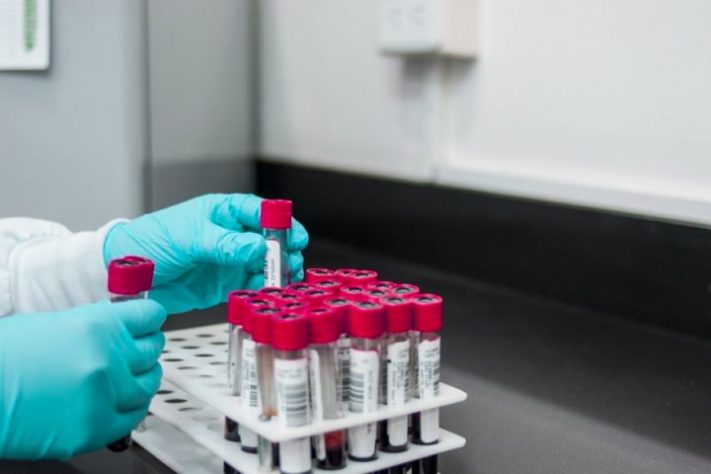 Ampolas de sangue - laboratório