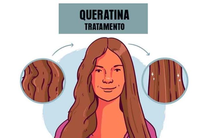 Queratina 