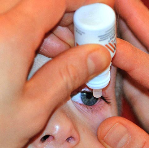 Seguir as orientaÃ§Ãµes de higiene, respeitar o tempo de uso indicado e realizar consultas regulares ao oftalmologista sÃ£o medidas fundamentais para quem deseja aproveitar os benefÃ­cios das lentes de contato sem comprometer a saÃºde dos olhos.