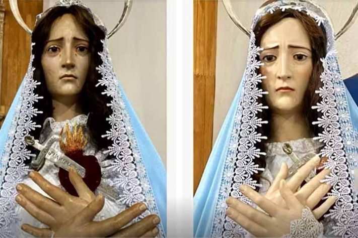 ‘Harmonização facial’ em santa