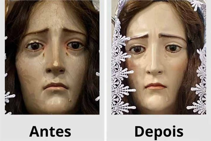 ‘Harmonização facial’ em santa