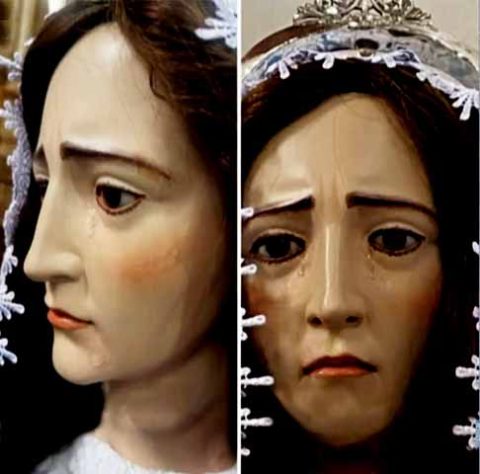 ‘Harmonização facial’ em santa