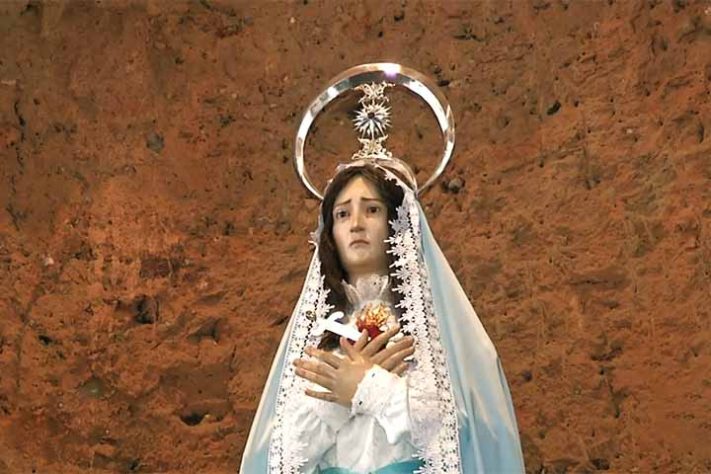 ‘Harmonização facial’ em santa