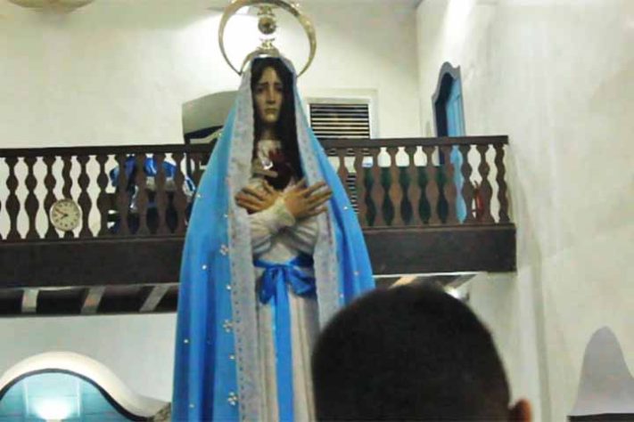 ‘Harmonização facial’ em santa