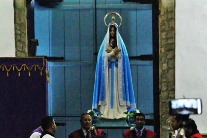 ‘Harmonização facial’ em santa