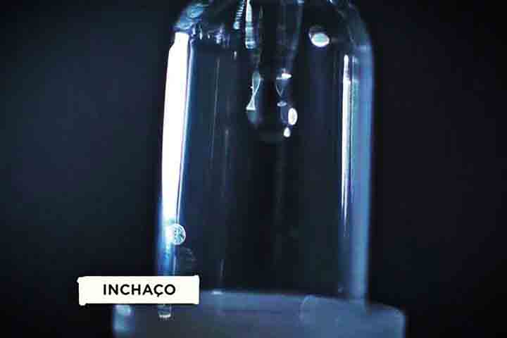 Essa superprodução de cortisol levou Sabrina a sofrer com a Síndrome de Cushing - doença endócrina provocada por elevados níveis do hormônio no organismo.- ©Reprodução de vídeo TV Globo