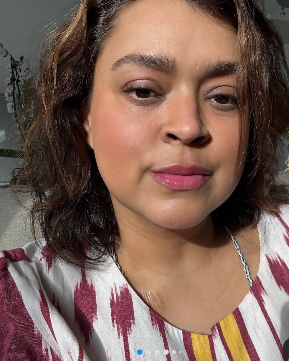 A cantora, que tratava um câncer de intestino que evoluiu para metástase no peritônio, recebeu alta hospitalar dez dias antes do show após mais de duas semanas internada.

