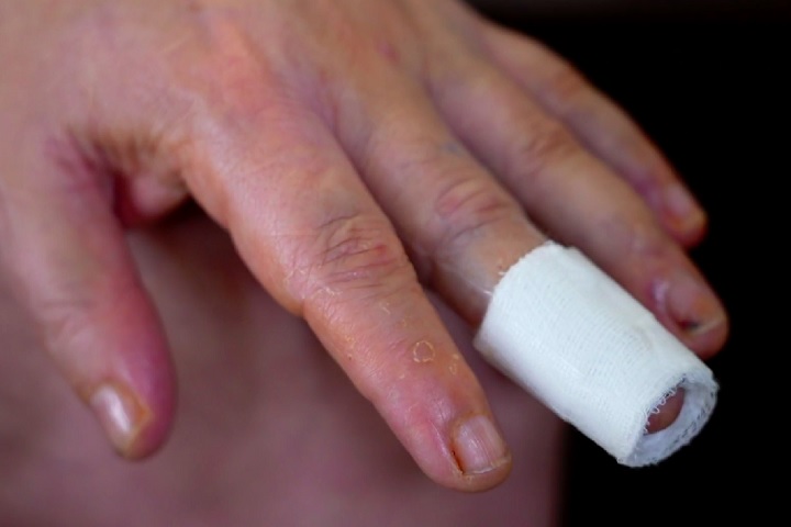 Ele precisou levar 15 pontos na testa, quebrou cinco costelas e machucou a mão. A queda aconteceu no fim do show, quando ele foi até o público para entregar flores. Marrone caiu de uma altura de 3 metros e chegou a desmaiar antes de ser levado ao hospital.