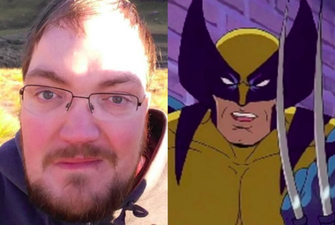 Wolverine? Condição rara faz homem ter ossos mais resistentes que granito