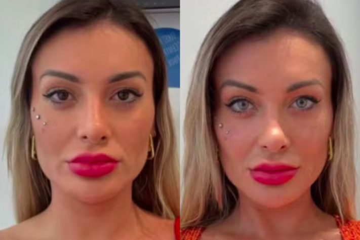 Montagem - Andrerssa Urach revela medo de ficar cega após cirurgia para mudar a cor dos olhos