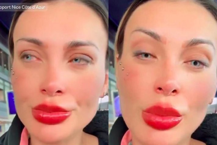 Montagem - Andrerssa Urach revela medo de ficar cega após cirurgia para mudar a cor dos olhos