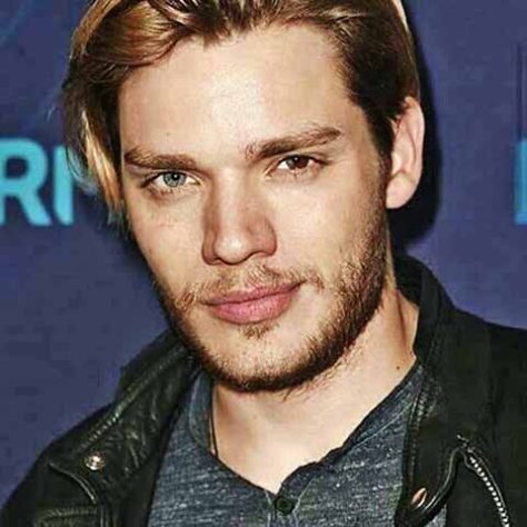Famosos com heterocromia 