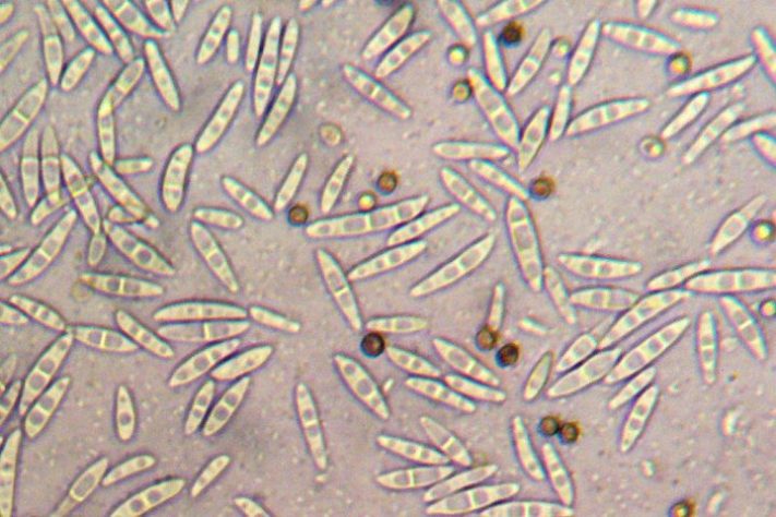 Fungo Fusarium oxysporum