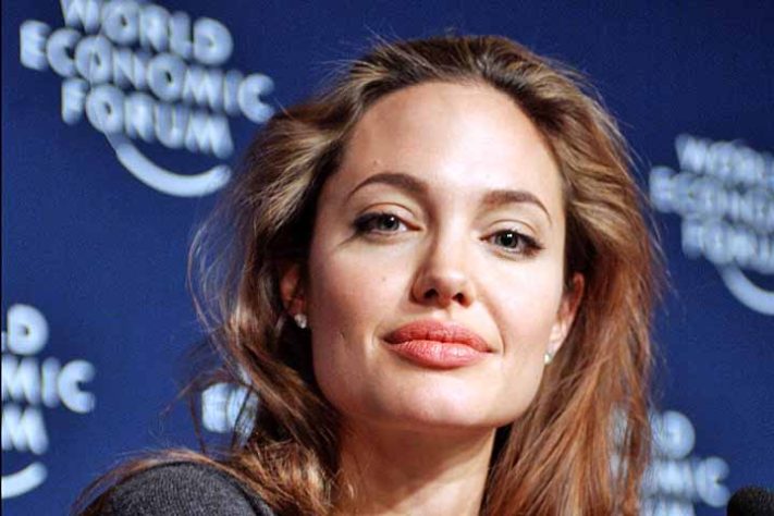 Famosos com heterocromia 