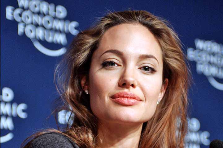 Angelina Jolie - A celebrada atriz de Hollywood apresenta heterocromia setorial em seus olhos — uma discreta variação de cor dentro da mesma íris, com tons que podem variar entre azul, verde, cinza e castanho dependendo da luz, maquiagem e contexto. 
