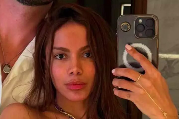 Anitta também negou os rumores de complicações médicas graves, como infecção bacteriana ou necessidade de dreno facial:-Reprodução/Instagram
