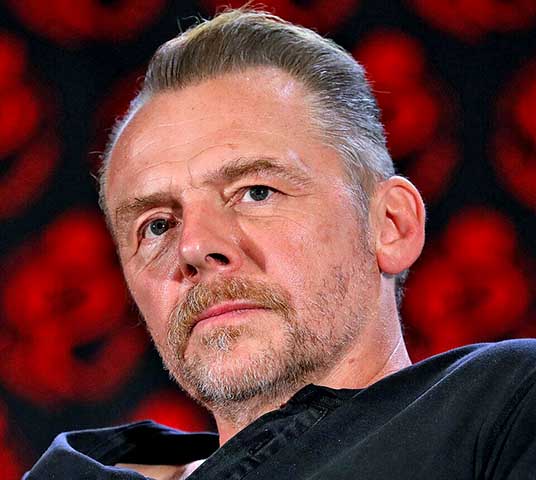 Simon Pegg - O comediante de filmes como "Todo Mundo Quase Morto" e  "Chumbo Grosso" possui heterocromia setorial. Ele já descreveu essa condição como “um pouquinho mutante”, explicando em um programa que seus “olhos são azul?cinza, mas no olho direito eu tenho um flash de marrom.”
