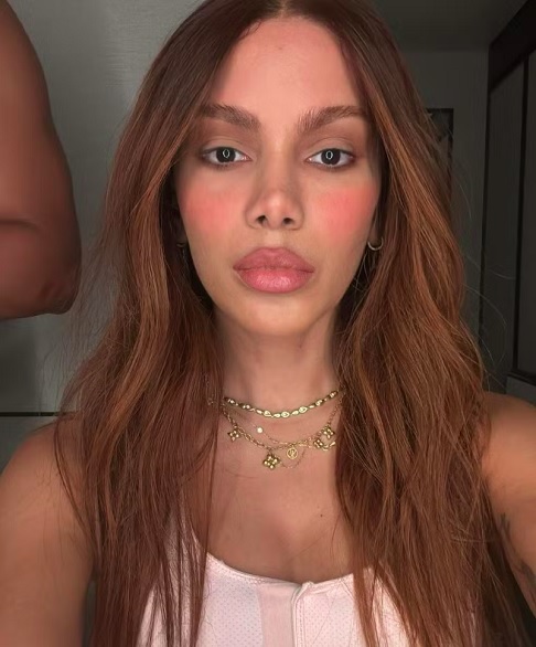 No dia 1/7, Anitta publicou uma foto no Instagram exibindo seu "novo rosto", mas acabou limitando os comentários por conta da repercussão negativa.-Reprodução/Instagram