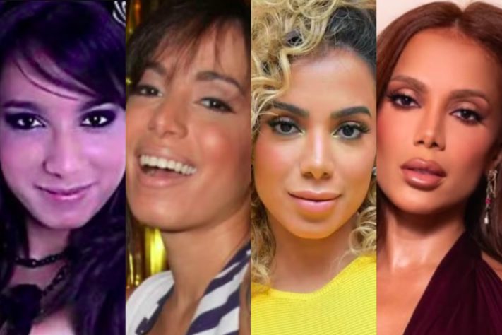 Anitta - procedimentos estéticos