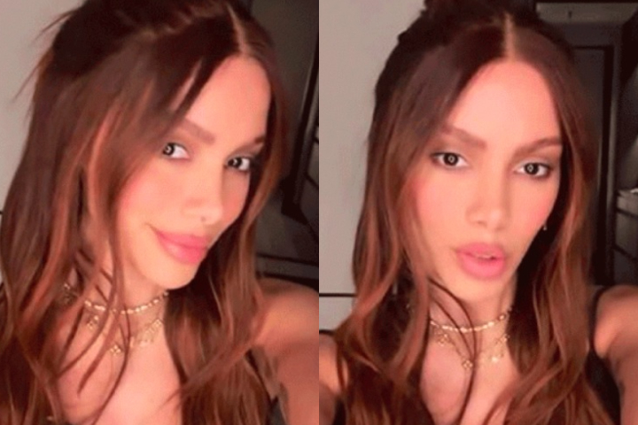 A cantora explicou que sempre fez intervenções estéticas, mas nem sempre as divulga publicamente.-Montagem/Reprodução/Redes Sociais 
