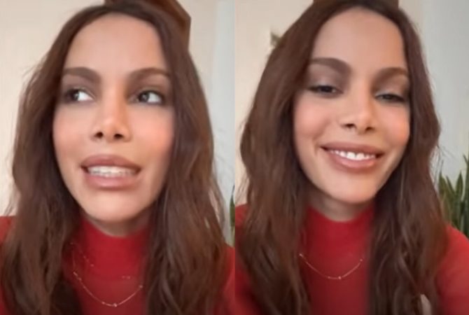 Anitta nega problemas de saúde e confirma novos procedimentos estéticos: ‘O corpo é meu’