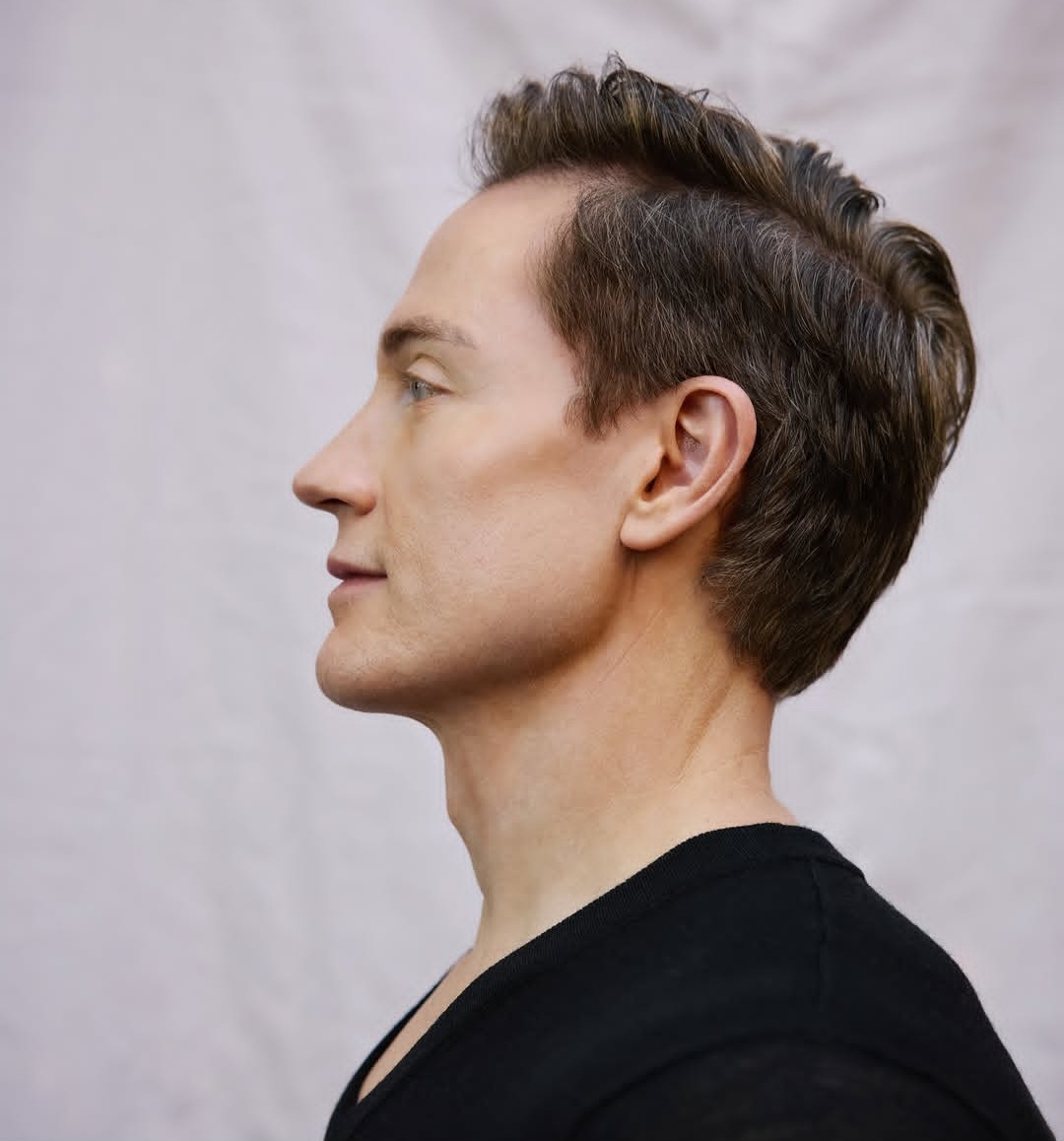 Se aparecer alguma mancha, ele tira. E faz um processo de renovação do colágeno. Ele tem um ponto preocupante: os cabelos. Usa boné com luz vermelha para proteção. Mas ainda não sabe como evitar os brancos.