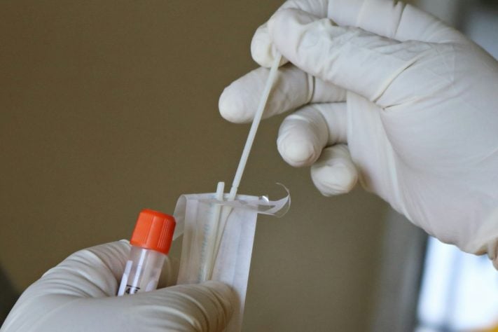 Teste/exame DNA