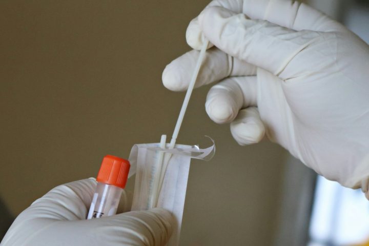 O teste é não invasivo (pode usar sangue ou saliva) e ajuda a entender o envelhecimento biológico, não apenas a idade cronológica.