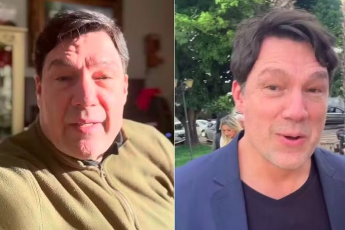 Ator Ricardo Macchi faz harmonização facial - Reprodução/Instagram