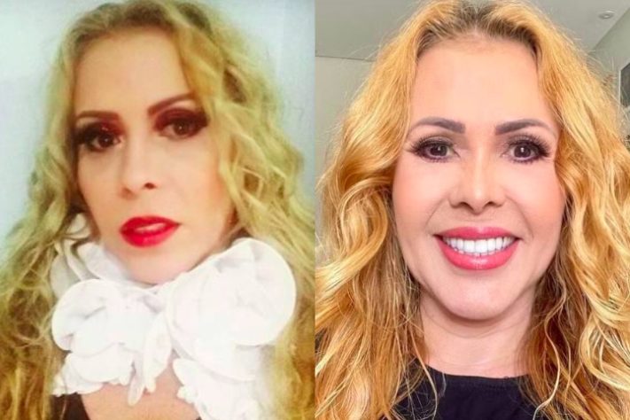 Joelma harmonização facial - Montagem/Reprodução/Instagram 