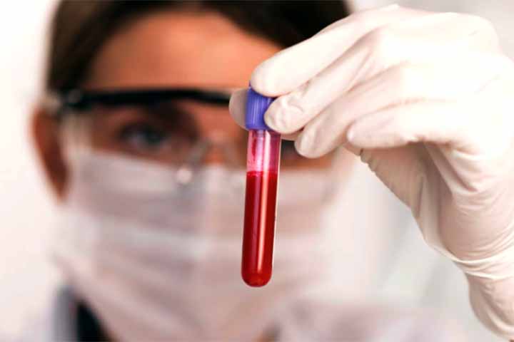 <p>O processo diagnóstico inclui um hemograma completo, exame que analisa os componentes do sangue. Ele pode revelar alterações importantes, como aumento de leucócitos imaturos ou redução significativa de células sanguíneas.</p>
