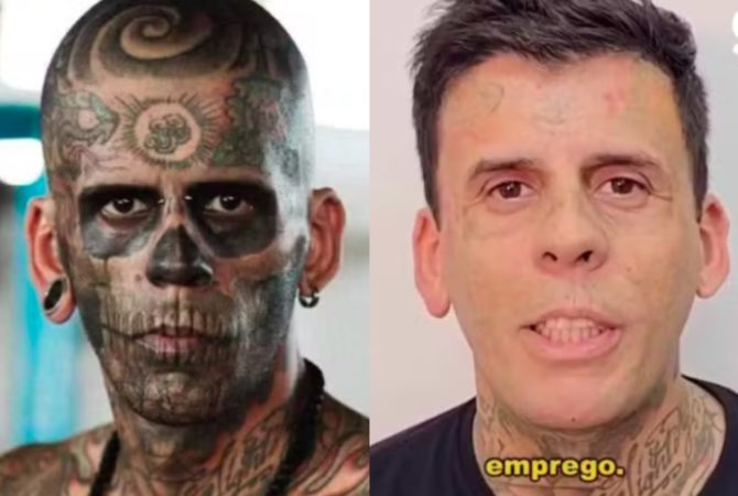 Após se converter, ‘mais tatuado do Brasil’ começa a remover tatuagens; veja!