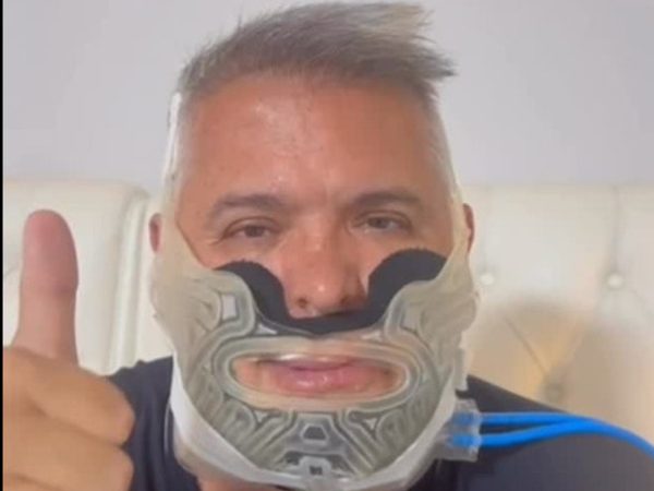 Apneia do sono: Orlando Morais revela cirurgia e faz um alerta