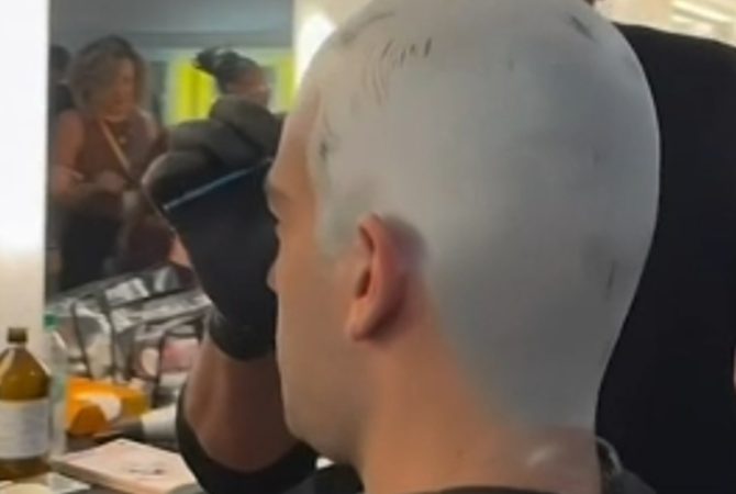 Personagem de Humberto Carrão fica careca, mas ator escapa; saiba como