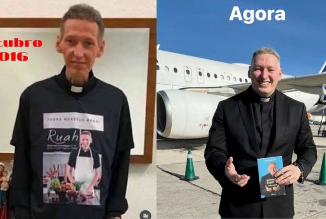 Padre Marcelo Rossi expõe em fotos a sua vitória contra a depressão: antes e depois do tratamento
