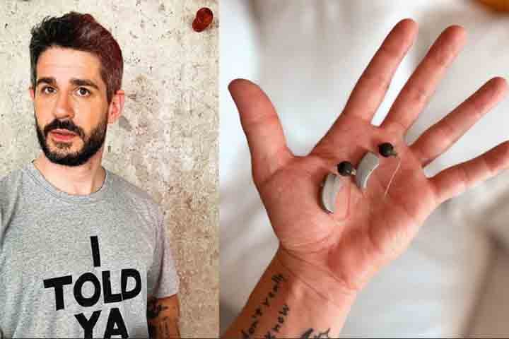 O ator foi diagnosticado com deficiência auditiva aos 18 anos, embora só tenha adotado o uso de aparelho auditivo mais adiante, já depois dos 30 anos.
