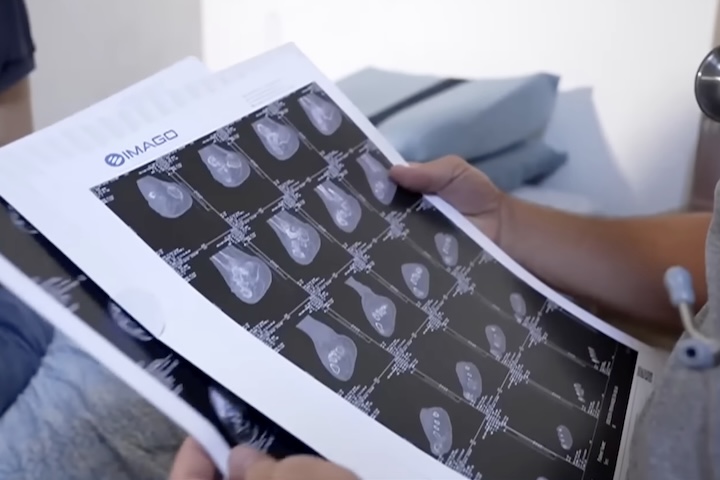 Algumas condições tornam as pessoas mais suscetíveis à osteomielite, como: sistema imunológico enfraquecido; diabetes; anemia falciforme; traumas ou lesões ósseas; tabagismo e alcoolismo.