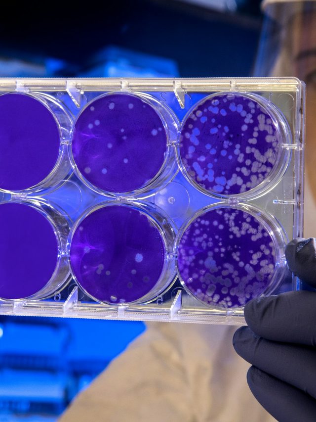 Resistência de superbactérias a antibióticos comuns faz OMS emitir alerta